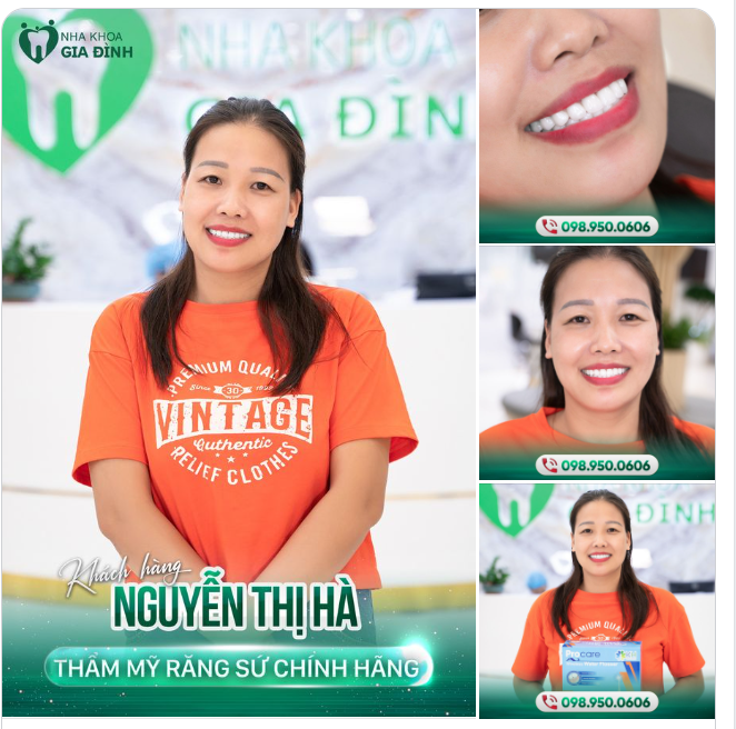 KẾT QUẢ NHẬN VỀ HOÀN TOÀN MỸ MÃN SAU KHI THẨM MỸ RĂNG SỨ