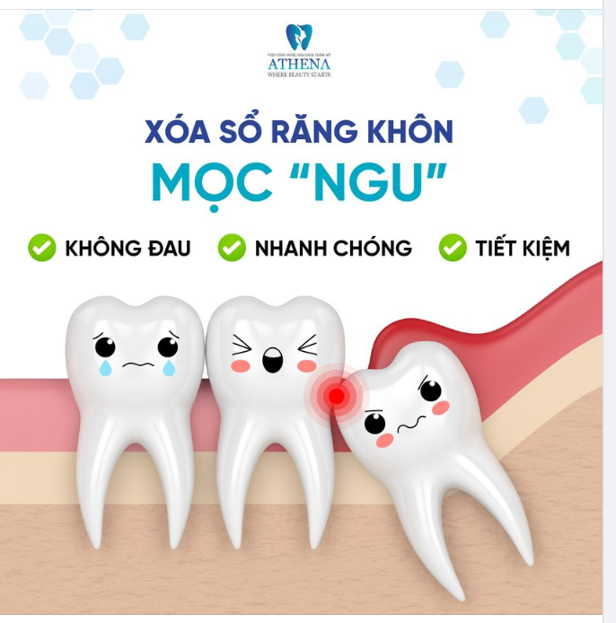 Xóa sổ răng khôn không đau - nhanh chóng - tiết kiệm tại ATHENA