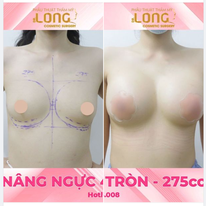 BÊN NGOÀI BÉ BỎNG BÊN TRONG NÓNG BỎNG Đố cả nhà đó là gì?