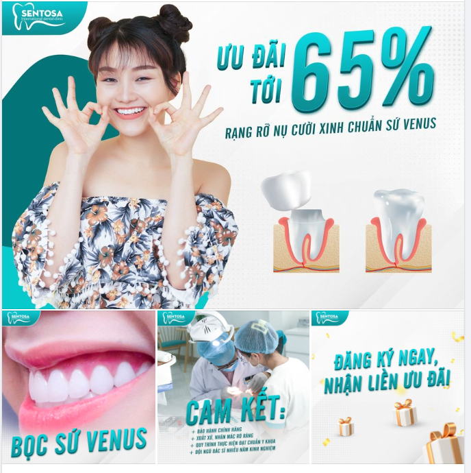 ƯU ĐÃI TỚI 65%: RẠNG RỠ NỤ CƯỜI XINH CHUẨN SỨ VENUS