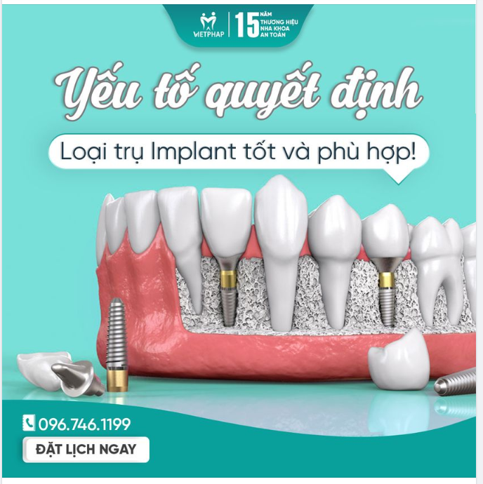 KHÔNG PHẢI CỨ DÙNG TRỤ IMPLANT ĐẮT ĐÃ LÀ TỐT!