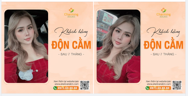 Hoa nào hoa đỏ bằng em. Cằm nào cằm gọn hài hòa nét xinh
