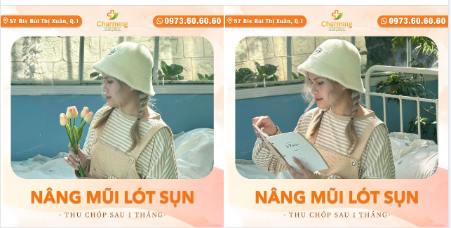 Sài Gòn thì nóng thiệt đó. Nhưng không có cái nóng nào… Bằng nóng lòng được thấy mũi lên form