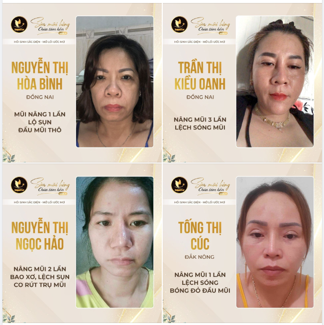 BÁC SĨ HOẠT – HỒI SINH SẮC DIỆN – MỞ LỐI ƯỚC MƠ “SỬA MŨI HỎNG – CHỮA TÂM HỒN” TIẾP TỤC NHẬN HỒ SƠ