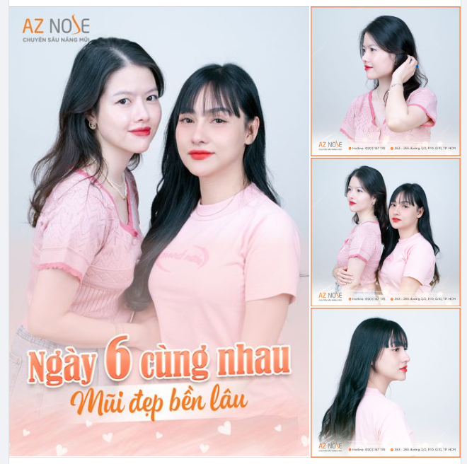 "Nâng mũi chung hời lắm. Vui hơn, mũi đẹp hơn, tiết kiệm hơn."