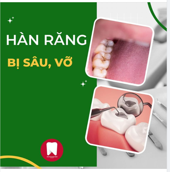 Đừng để sâu răng, vỡ răng làm ảnh hưởng đến sức khỏe răng miệng của bạn!