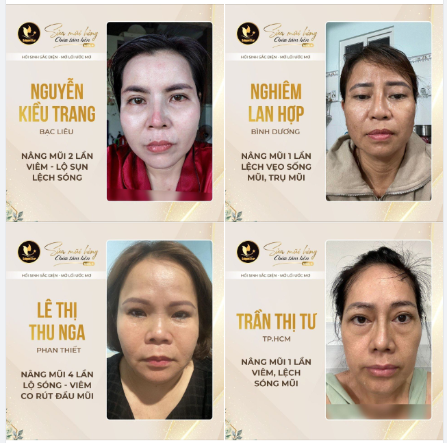 BÁC SĨ HOẠT – HỒI SINH SẮC DIỆN – MỞ LỐI ƯỚC MƠ “SỬA MŨI HỎNG – CHỮA TÂM HỒN” TIẾP TỤC NHẬN HỒ SƠ