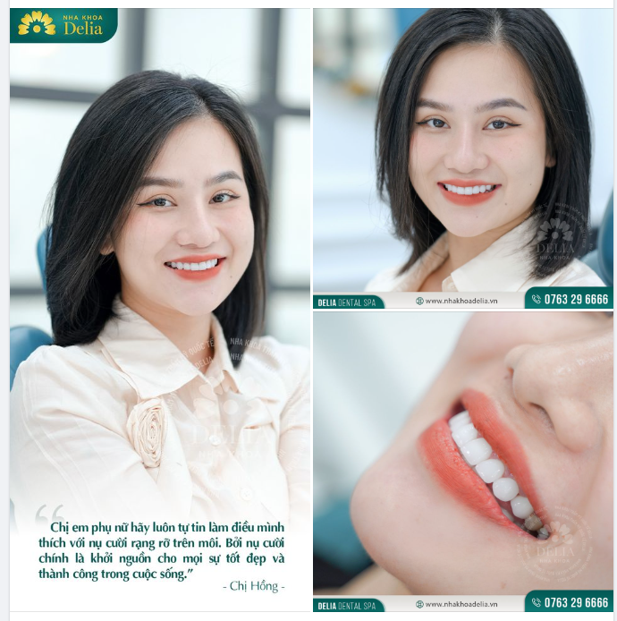 Chân thành cảm ơn sự yêu mến và tin tưởng mà chị Phạm Thị Hồng đã dành cho bác sĩ và đội ngũ nha khoa Delia.