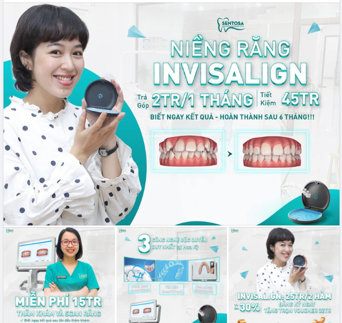 NIỀNG RĂNG INVISALIGN:
