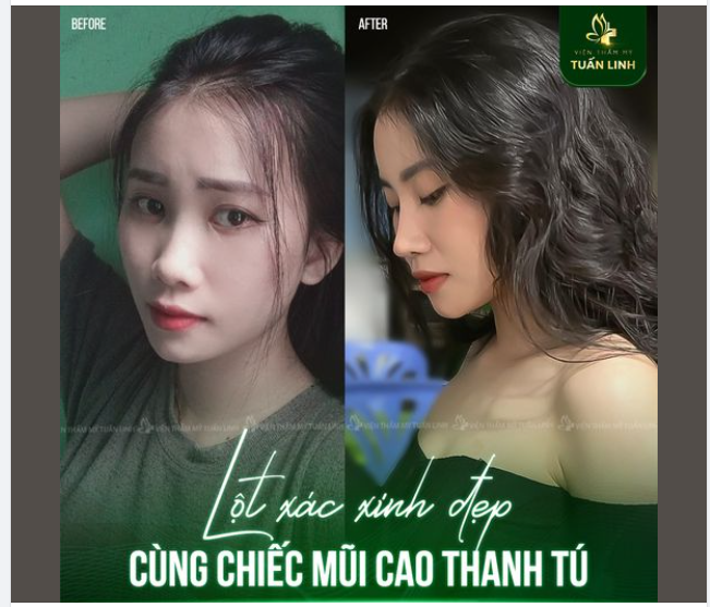 Minh chứng cho việc '' Chiếc mũi là ''linh hồn'' của cả gương mặt'' là đây ạ!!