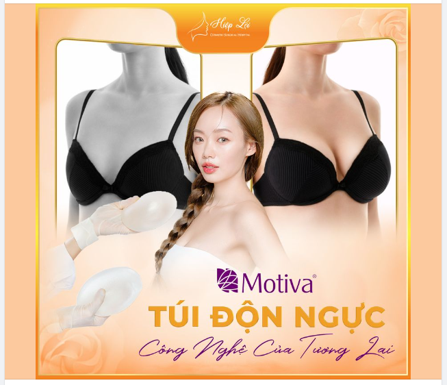 MOTIVA – TÚI ĐỘN NGỰC HOT HIT – “CÔNG NGHỆ CỦA TƯƠNG LAI” ️