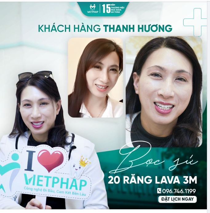 RĂNG SỨ LAVA 3M - GIẢI PHÁP HOÀN HẢO CHO NỤ CƯỜI TỰ TIN