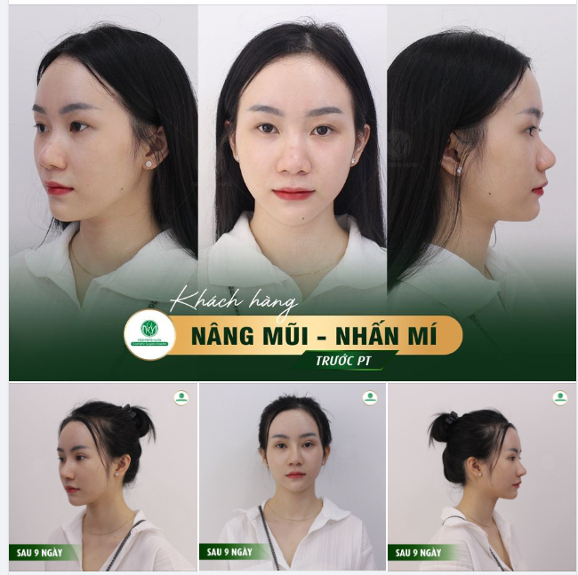 Em Đây Chẳng Phải Thúy Kiều. Nhưng Mà Nhan Sắc Cũng Mỹ Miều Như Ai