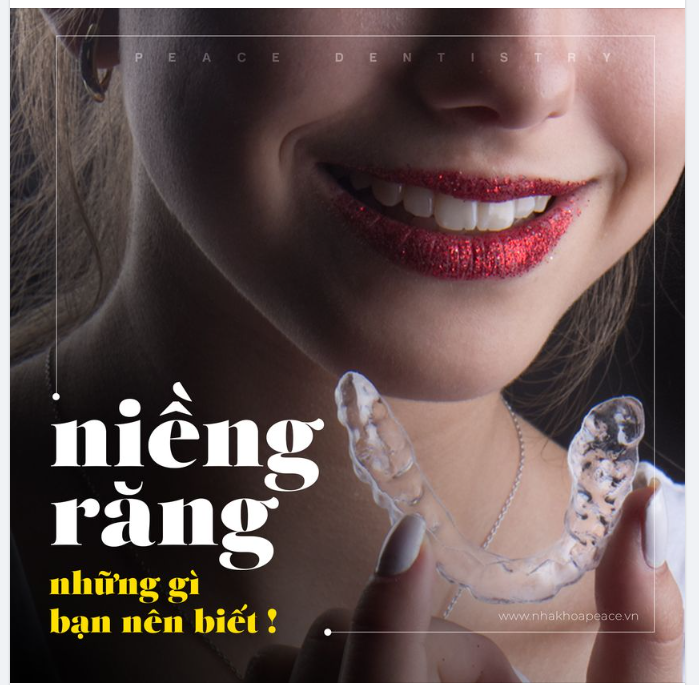 9 CÂU HỎI PHỔ BIẾN NHẤT VỀ NIỀNG RĂNG
