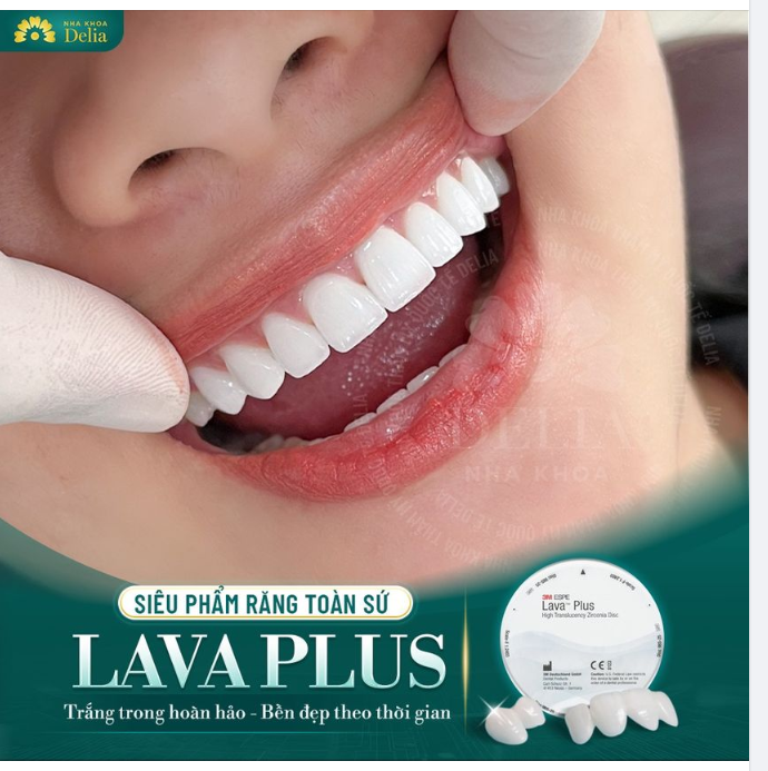 Răng sứ Lava Plus - Đỉnh cao răng toàn sứ tại nha khoa Delia