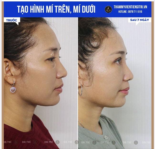 THỬ THÁCH 7 NGÀY THAY ĐỔI
