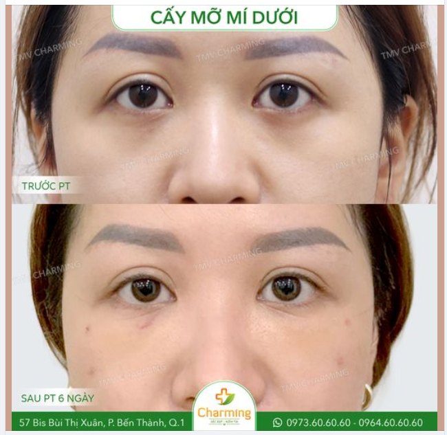 Mọi người luôn mong muốn có một đôi mắt to tròn, nhưng cũng có khi đôi mắt to tròn quá... lại là vấn đề .-.