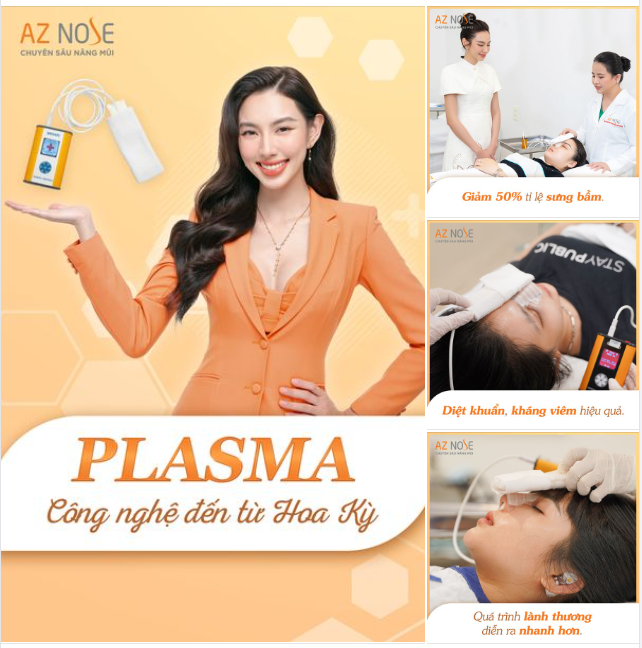 ​​​​​​​3 lí do bạn nên chiếu Plasma sau khi nâng mũi!