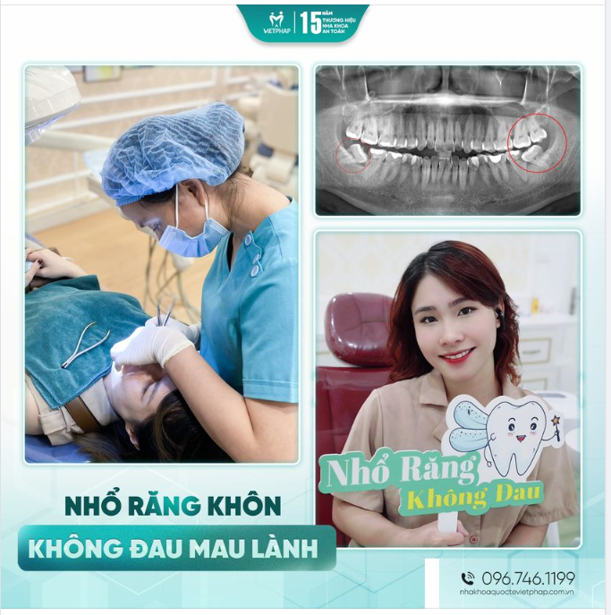 NHỎ RĂNG 8 - KHÔNG ĐAU MAU LÀNH