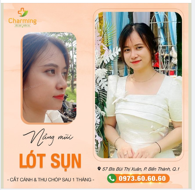 Bầu trời thì xanh Đám mây thì trắng Nhưng anh say nắng Vì mải ngắm em