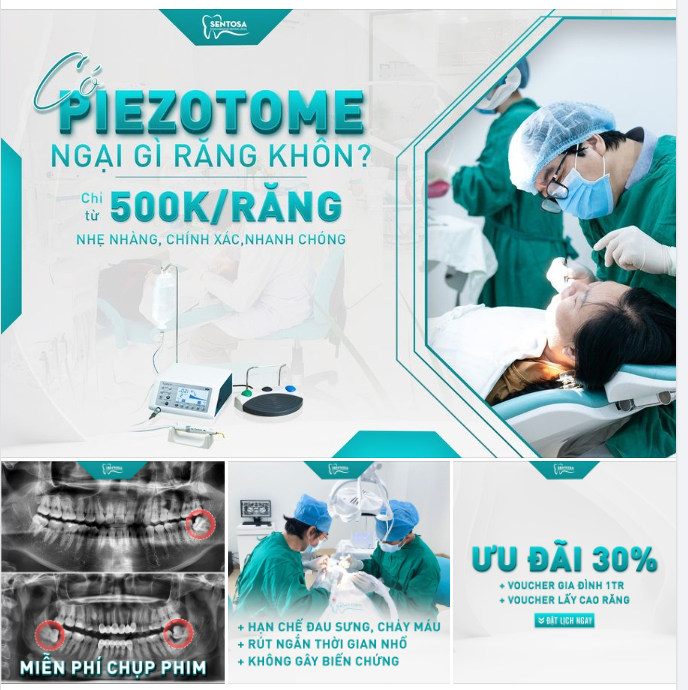 CÓ PIEZOTOME NGẠI GÌ RĂNG KHÔN?