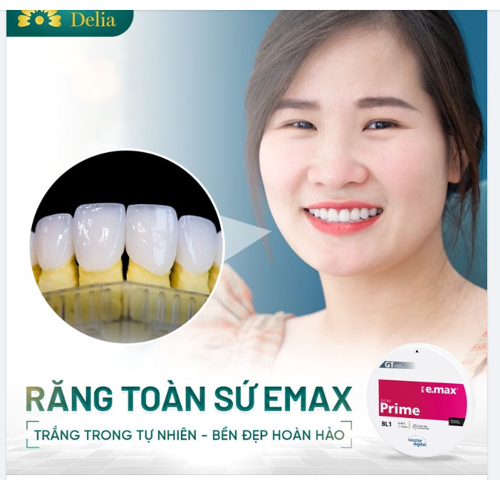 Răng toàn sứ Emax - Trắng trong tự nhiên, bền đẹp hoàn hảo đến từng milimet
