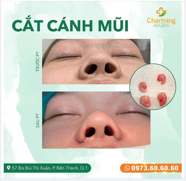 PHẪU THUẬT ĐƯỢC GỌI LÀ “MỘT ĐI KHÔNG TRỞ LẠI” LÀ GÌ?