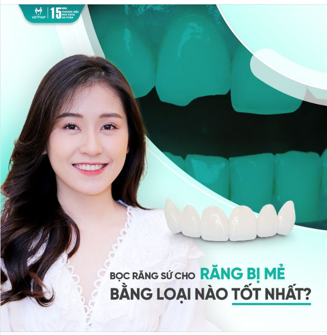 BỌC RĂNG SỨ - KHẮC PHỤC TÌNH TRẠNG RĂNG MẺ