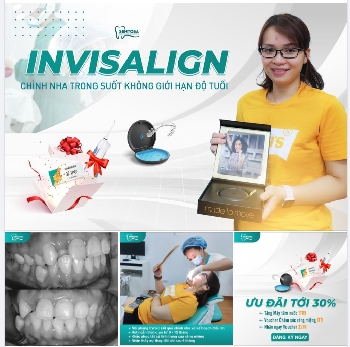 INVISALIGN: CHỈNH NHA TRONG SUỐT KHÔNG GIỚI HẠN ĐỘ TUỔI