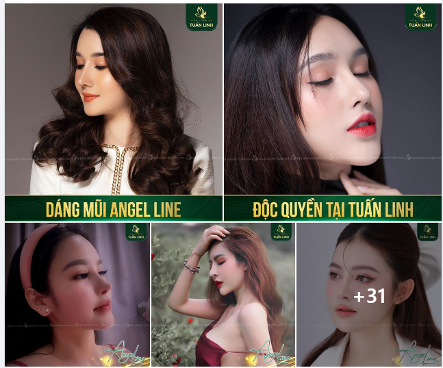 Sở hữu dáng mũi Angel Line độc quyền tại Tuấn linh -cùng gói trả góp 0% lãi suất