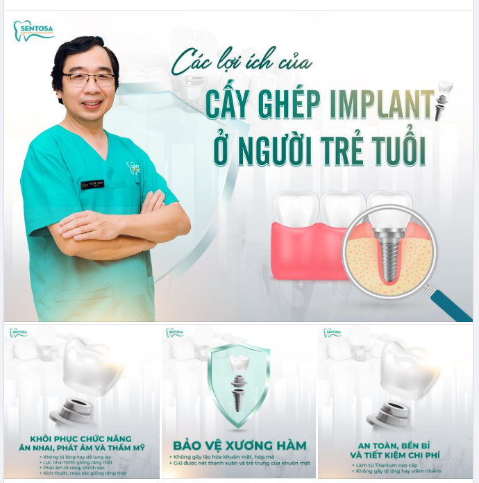 CÁC LỢI ÍCH CỦA CẤY GHÉP IMPLANT CHO SỨC KHỎE RĂNG MIỆNG Ở NGƯỜI TRẺ TUỔI