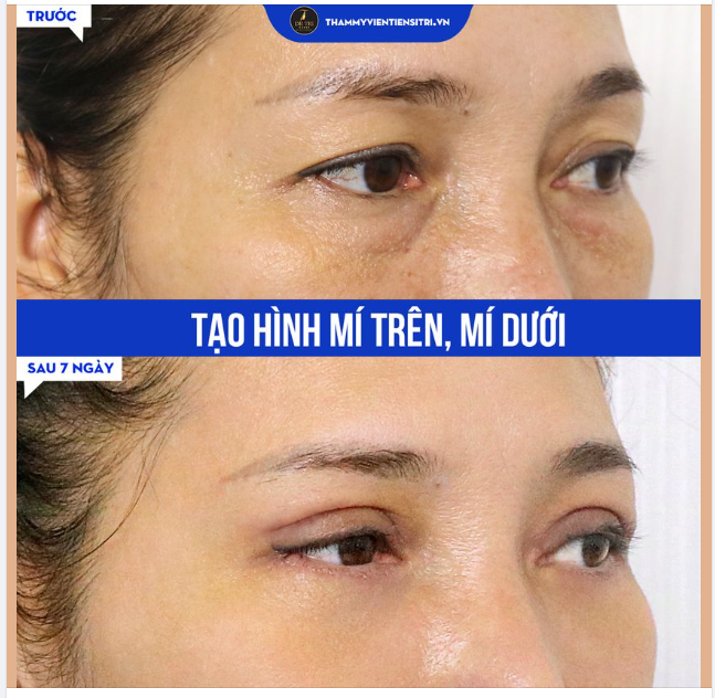 KHÁC LẠ TỪ GÓC NGHIÊNG SAU 7 NGÀY