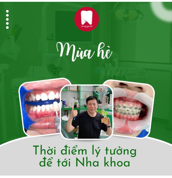 MÙA HÈ – THỜI ĐIỂM LÝ TƯỞNG NHẤT ĐỂ THỰC HIỆN TẤT CẢ CÁC DỊCH VỤ NHA KHOA!