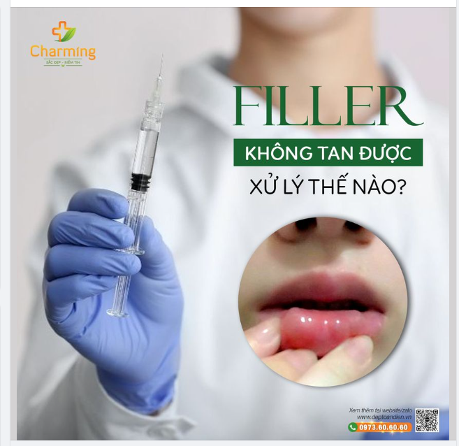 FILLER KHÔNG TAN ĐƯỢC XỬ LÝ THẾ NÀO?