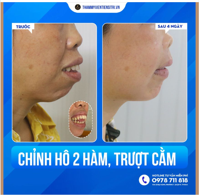 THAY ĐỔI CUỘC SỐNG - HẾT BỊ CHÊ CƯỜI VÌ HÔ