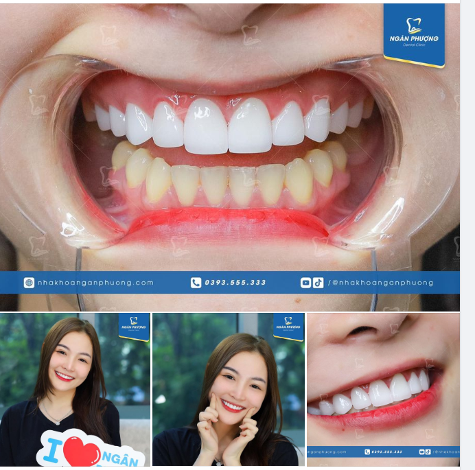 Chỉ làm hàm trên, Thanh Thảo vẫn có được nụ cười toả nắng