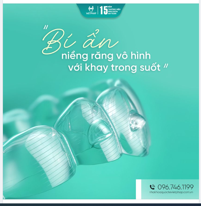 Niềng răng Invisalign - đỉnh cao niềng răng thế hệ mới