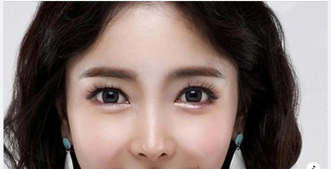 Tiêu chí chọn địa chỉ cắt mí mắt uy tín bạn nên biết là gì?