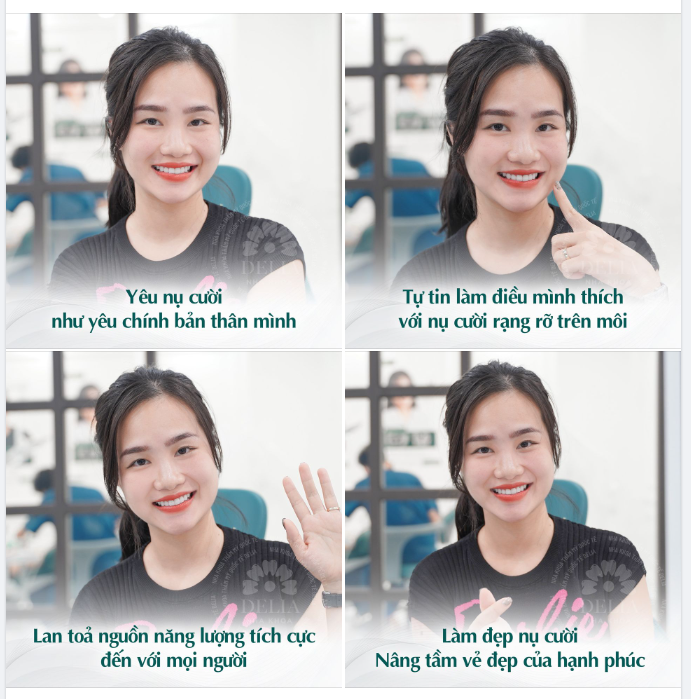 Làm đẹp nụ cười - Nâng tầm vẻ đẹp của hạnh phúc