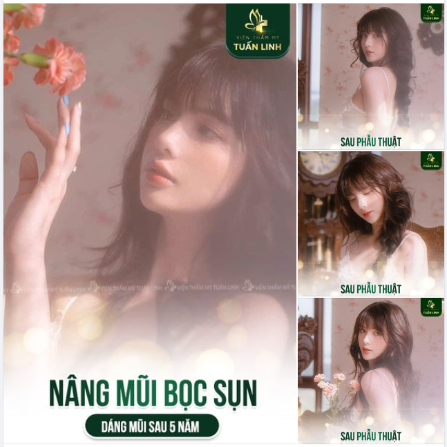 Nâng mũi bọc sụn có bền đẹp không? Câu trả lời ngay phía dưới đây