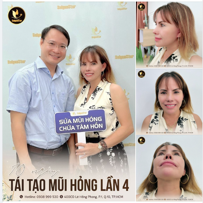 10 NGÀY TÁI TẠO MŨI HỎNG LẦN 4