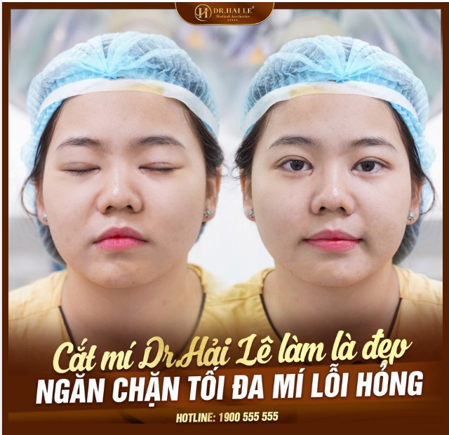 Đôi mắt sáng với hai nếp mí rõ ràng là nét đẹp gây không biết bao thương nhớ. Chỉ với điểm đó cũng đủ để cả gương mặt tràn ngập sức sống và bừng sáng.