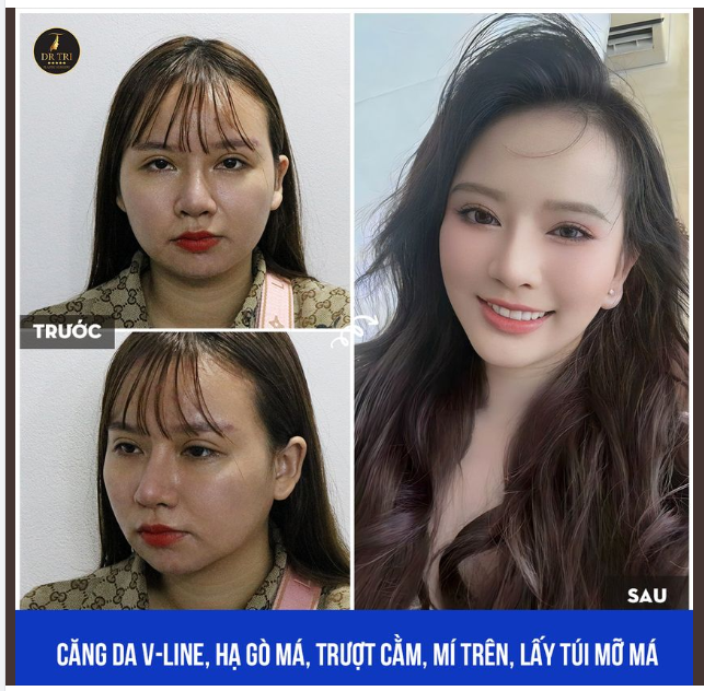 PHỤ NỮ SẼ RẠNG RỠ KHI TỰ TIN MÌNH ĐẸP
