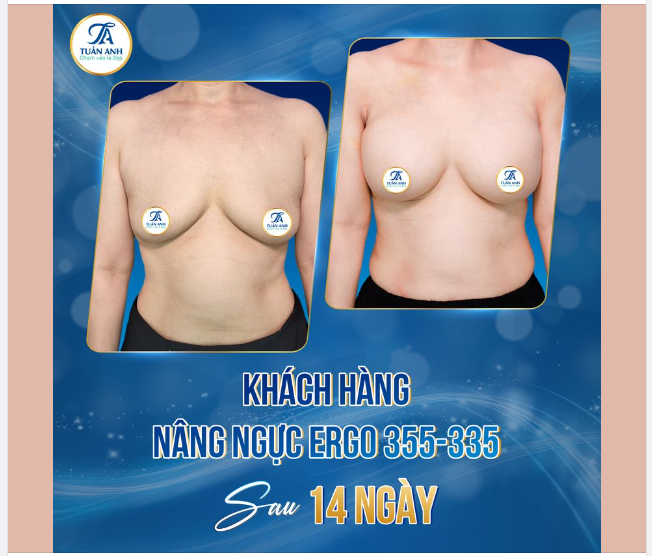 HÀNH TRÌNH MANG LẠI VẺ ĐẸP…Thêm 1 chị khách đến từ Huế thương, trộ ôi, gái Huế vừa xinh vừa hiền cạ nhà ơi.