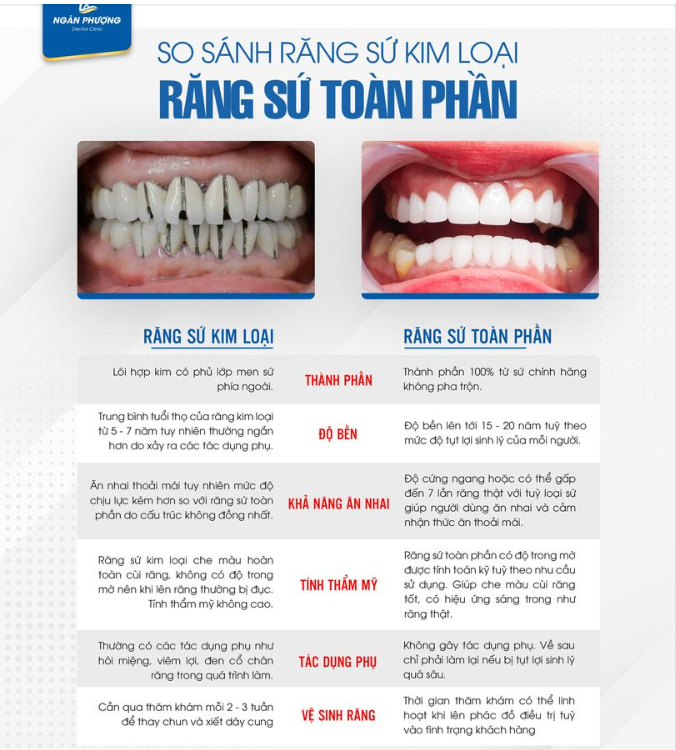 Bổ quả sứ kim loại mới thấy tại sao răng sứ nói chung lại mang nhiều tiếng xấu đến vậy.