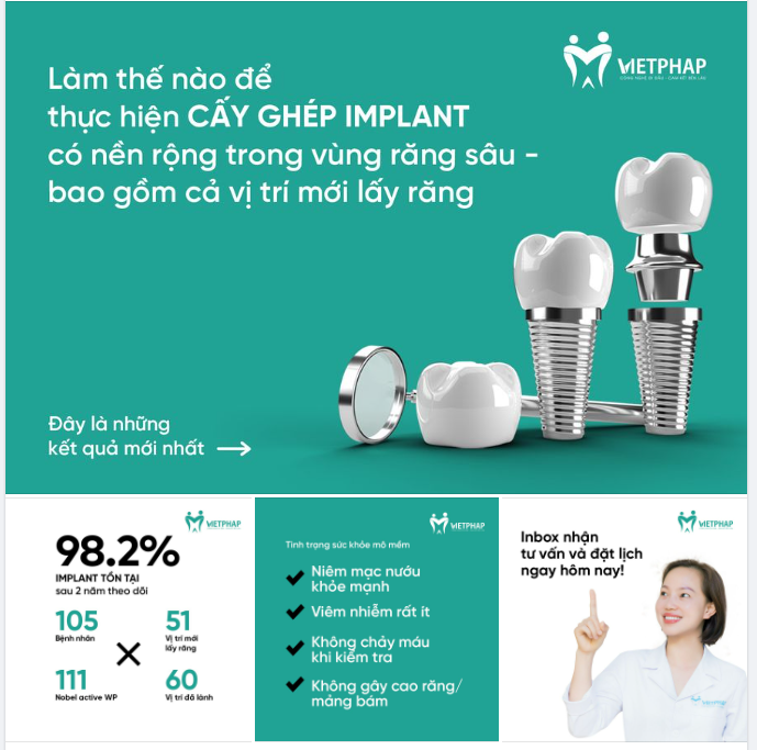 Quá trình điều trị và cấy ghép Implant ở vùng răng hàm sâu