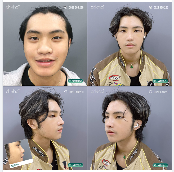 ĐẸP TRAI - PHONG CÁCH - TỰ TIN DÁNG MŨI MỚI CHO MỘT KHỞI ĐẦU MỚI