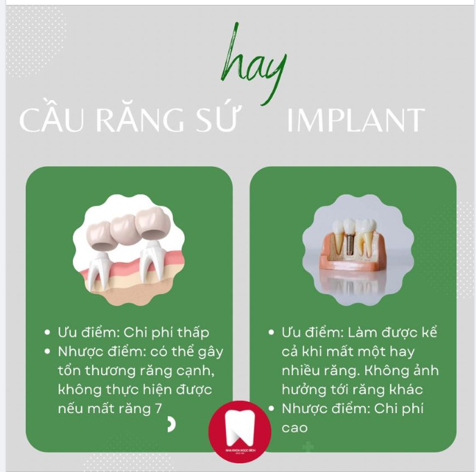 NÊN TRỒNG RĂNG BẰNG CẦU RĂNG SỨ HAY CẤY GHÉP IMPLANT?