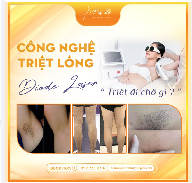DIODE LASER – TRIỆT ĐI CHỜ GÌ?
