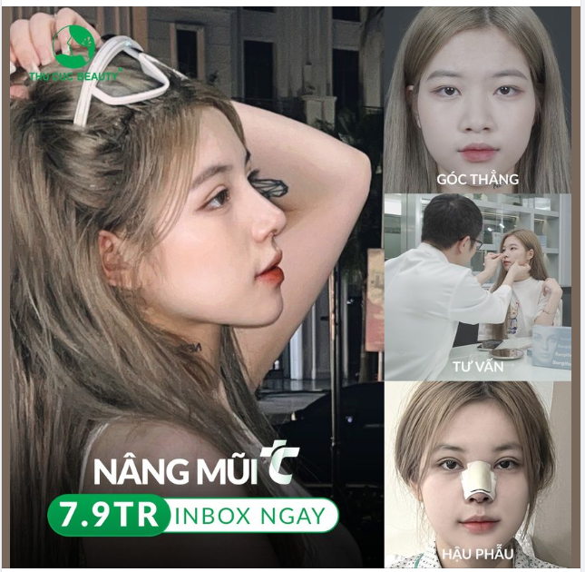 Mũi cao 7.9TR giống hot tiktoker Ngân Hà